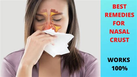 Putting a few drops of brahmi ghee or saline solution into the nose will also lubricate the nasal passage and facilitate removal of the. . Nasal crusting treatment